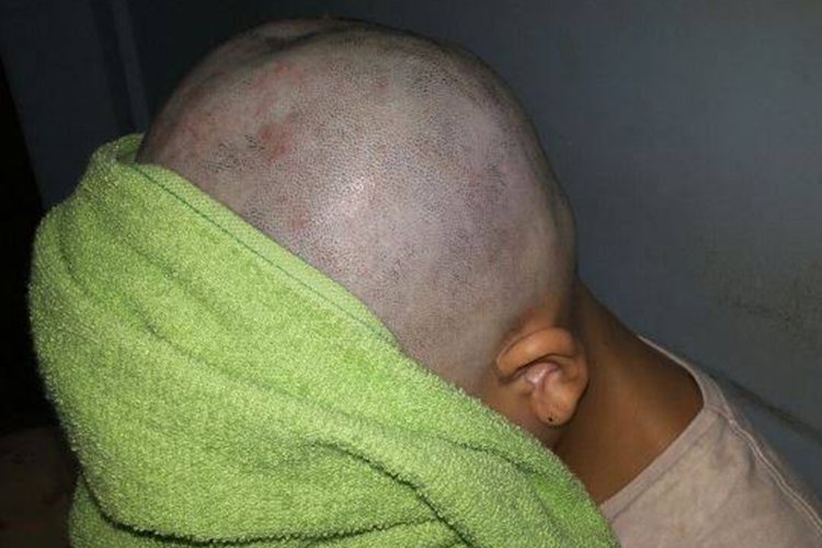 Read more about the article Pai raspa o cabelo da filha após ela fazer bullying com menina com câncer